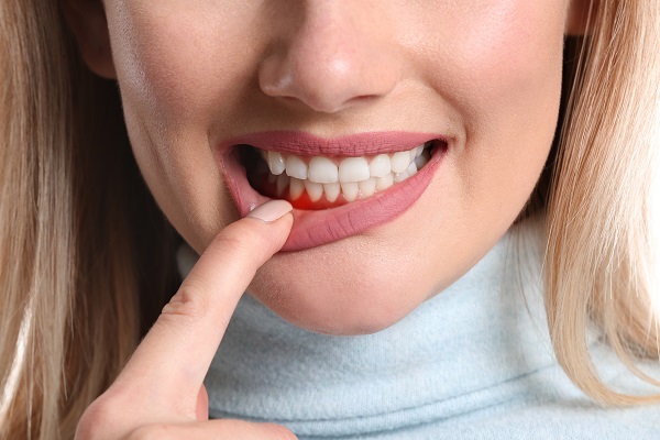 Gum Disease Prevention Tips