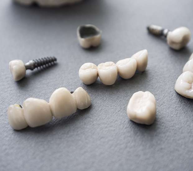 Rockville Centre The Difference Between Dental Implants and Mini Dental Implants