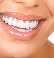 Teeth Whitening Services Rockville Centre, NY