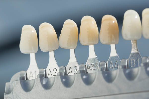 What Are Veneers Made Of?